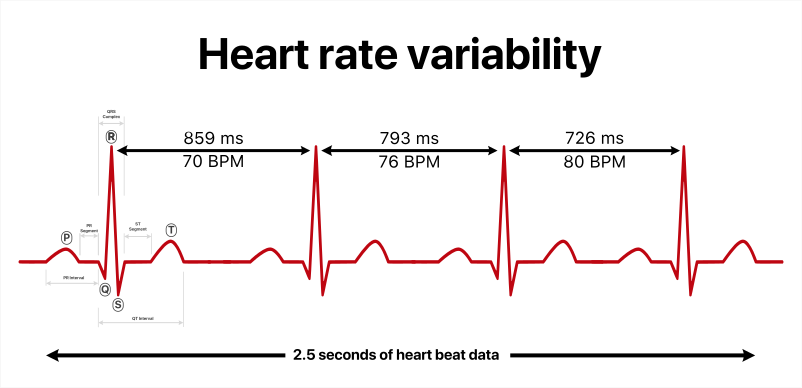 #14. Variabilidad de la frecuencia cardíaca, ¿por qué debes saber la tuya?